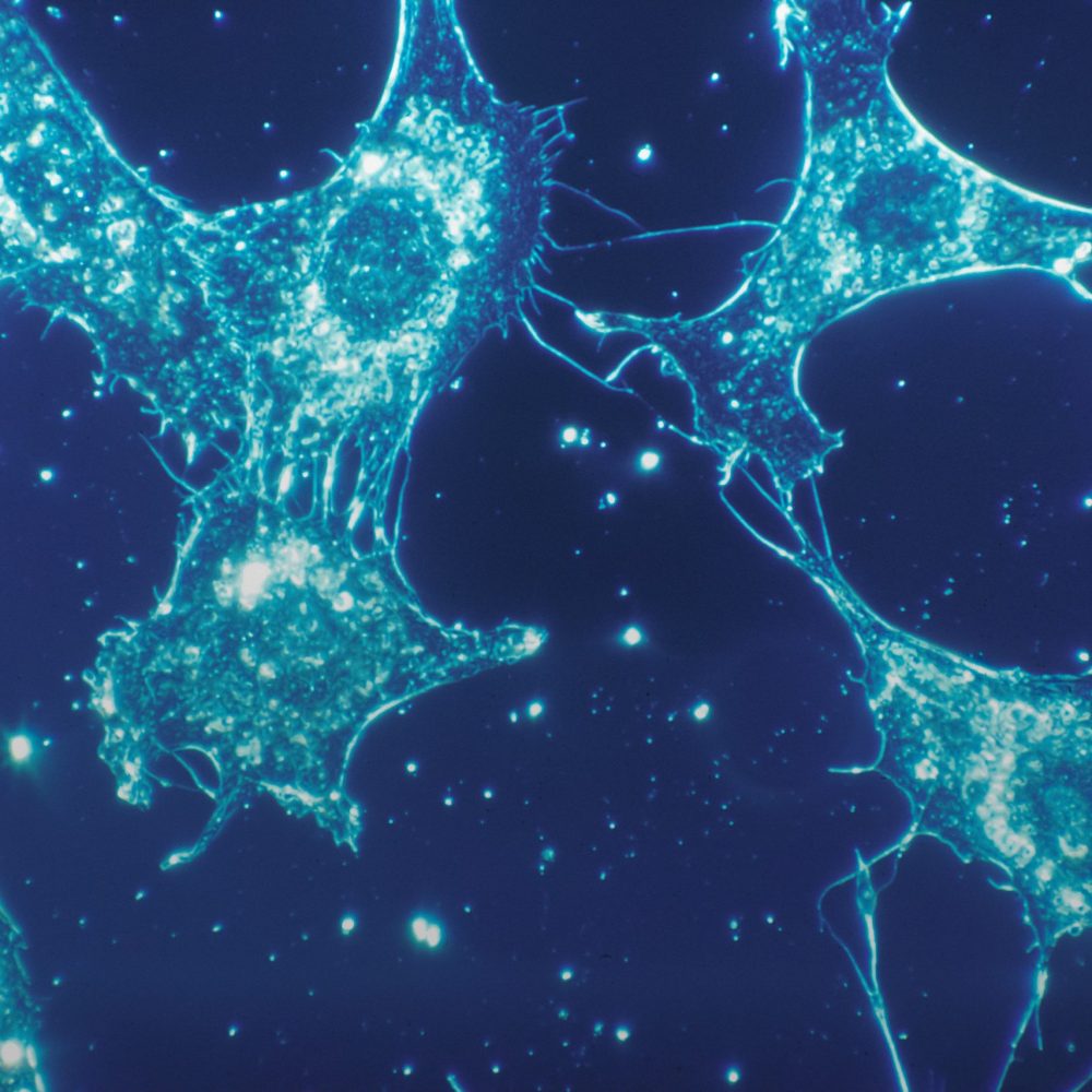 national-cancer-institute-1PpyUZceg_I-unsplash national-cancer-institute-1PpyUZceg_I-unsplash